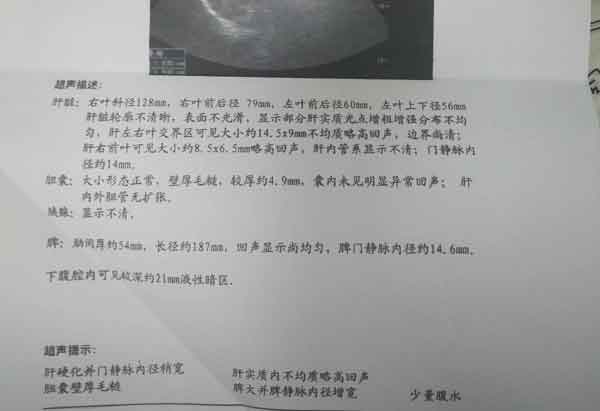郑州肝硬化医院哪个好?郑州哪个医院肝病专科好